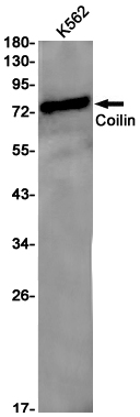 Coilin Rabbit mAb ABZ2526