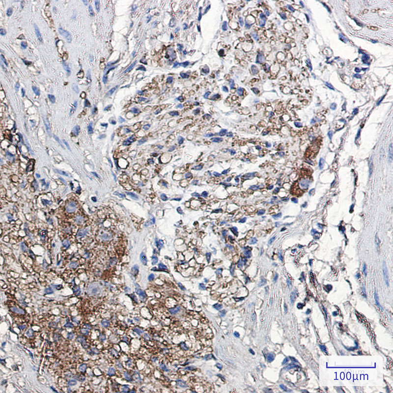 alpha Synuclein Rabbit mAb ABZ2528