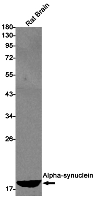 alpha Synuclein Rabbit mAb ABZ2528