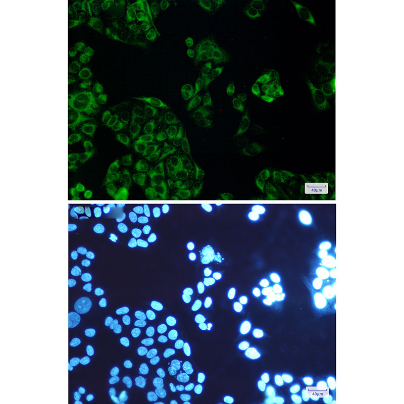 FDFT1 Rabbit mAb ABZ2529