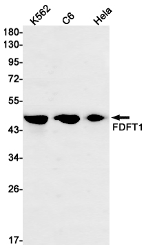 FDFT1 Rabbit mAb ABZ2529