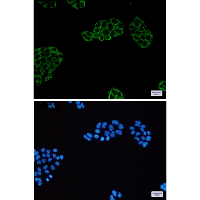 PGM1 Rabbit mAb ABZ2531