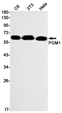 PGM1 Rabbit mAb ABZ2531