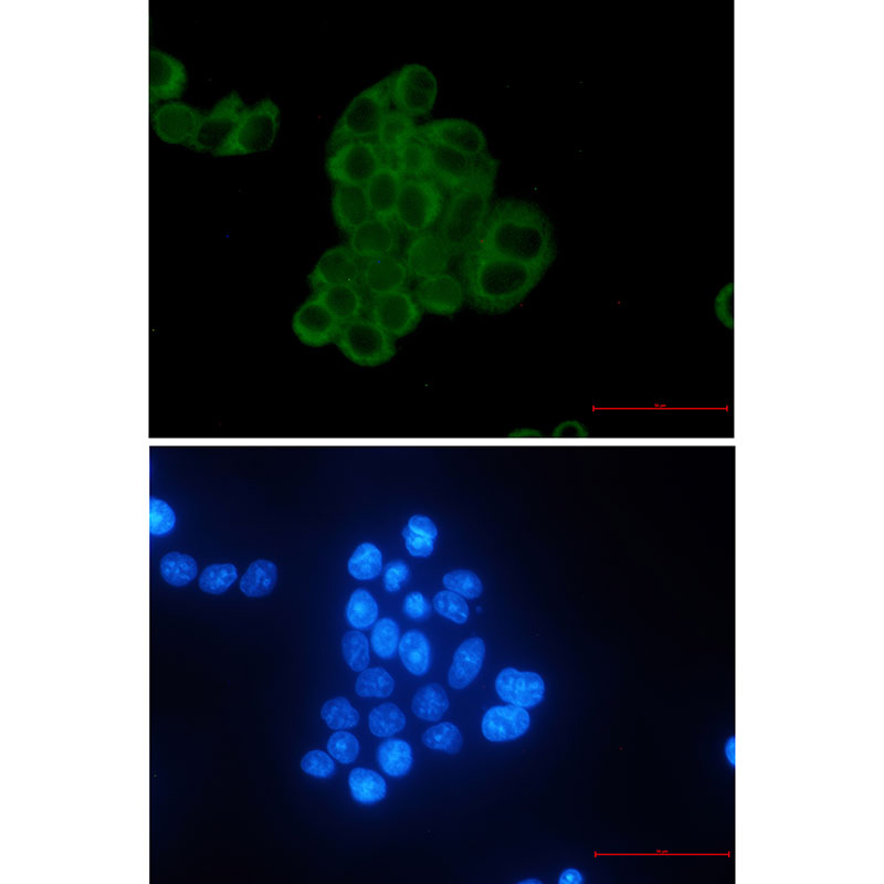 MEK2 Rabbit mAb ABZ2533