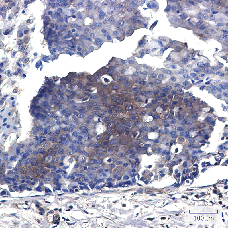 MEK2 Rabbit mAb ABZ2533