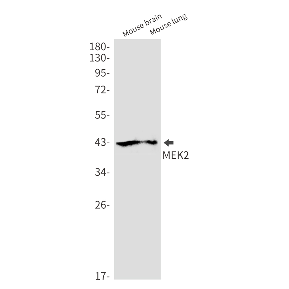 MEK2 Rabbit mAb ABZ2533
