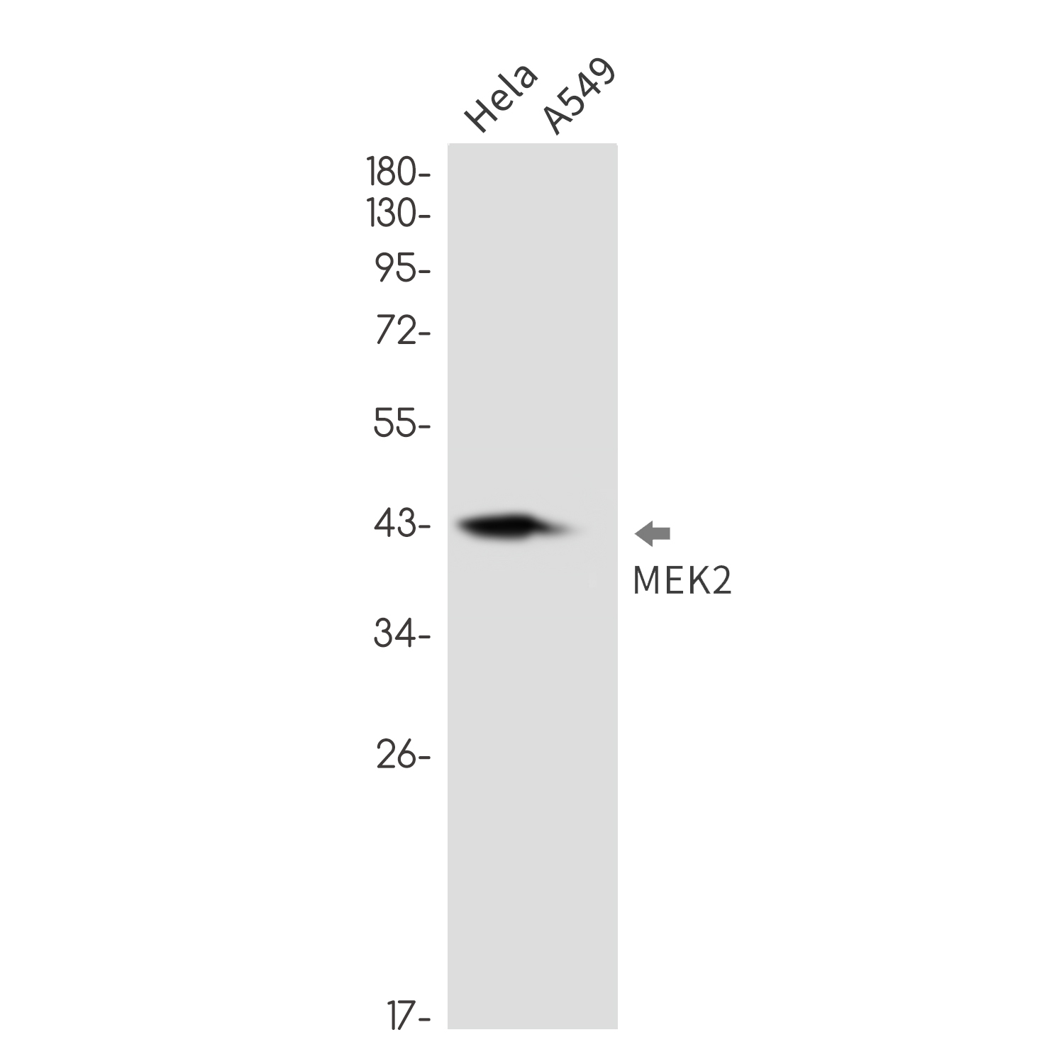 MEK2 Rabbit mAb ABZ2533