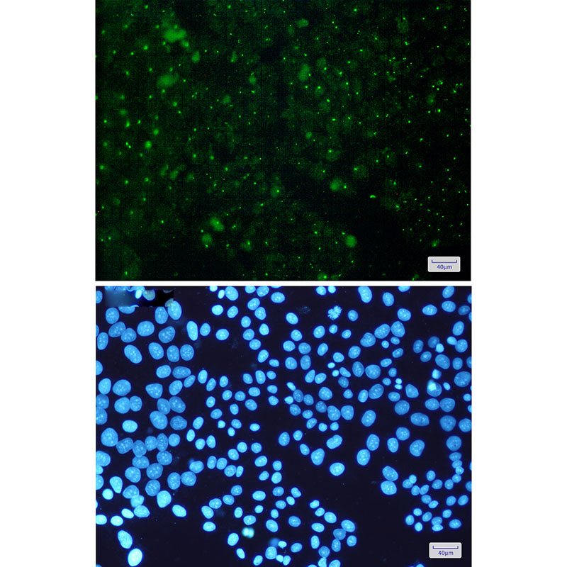 Aryl hydrocarbon Receptor Rabbit mAb ABZ2534