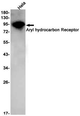 Aryl hydrocarbon Receptor Rabbit mAb ABZ2534