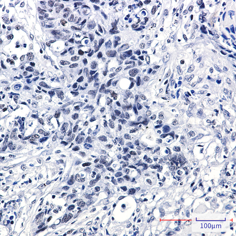 DEK Rabbit mAb ABZ2535