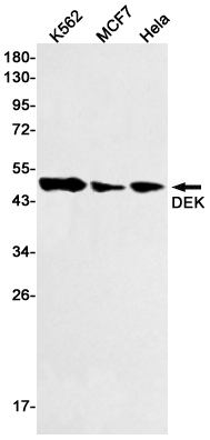 DEK Rabbit mAb ABZ2535