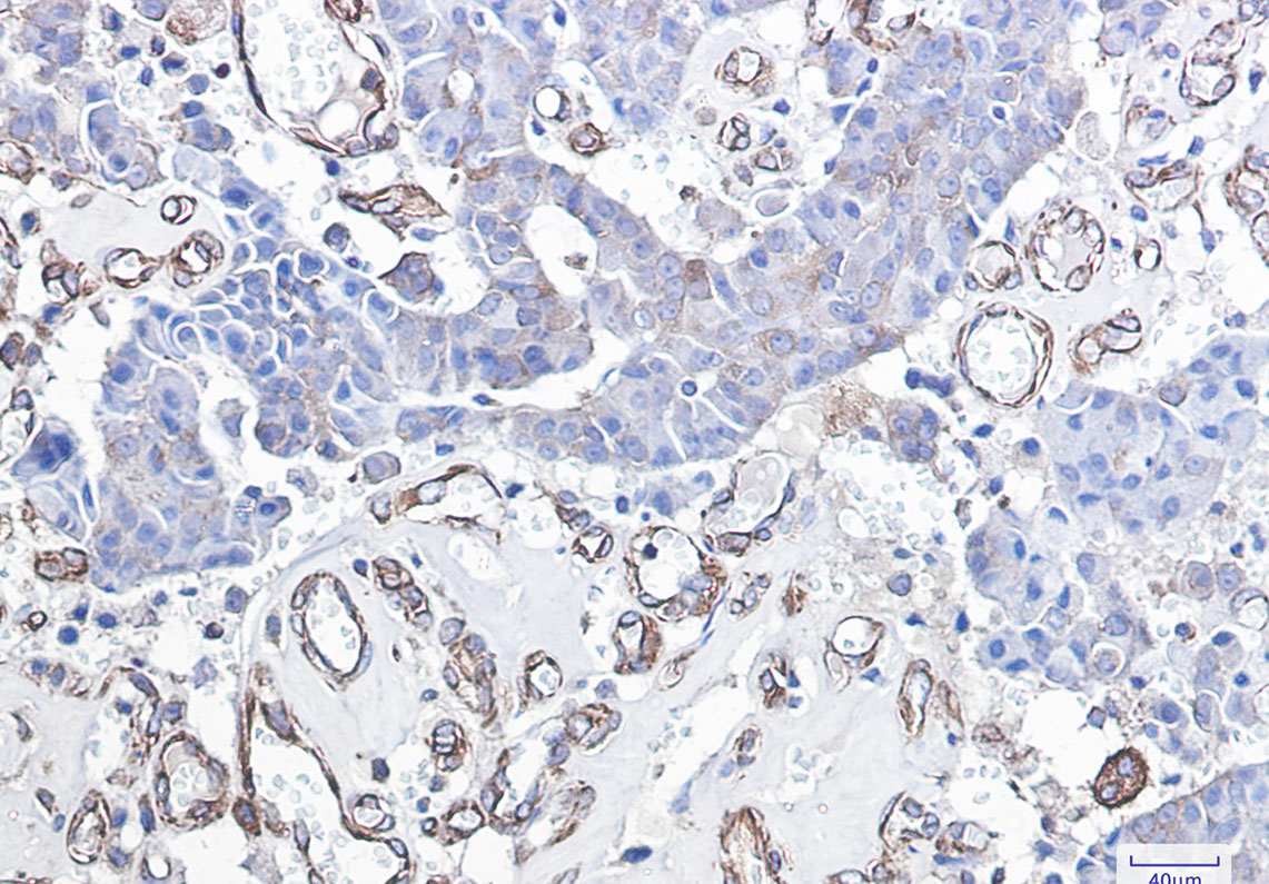 DDIT3 Rabbit mAb ABZ2536