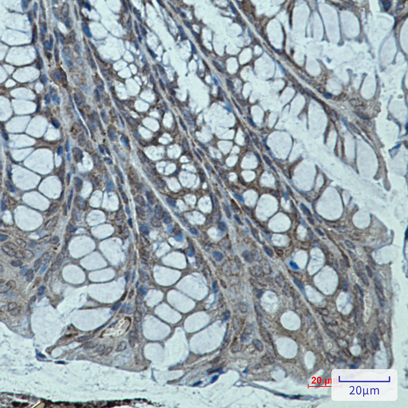 Sarcomeric alpha Actinin Rabbit mAb ABZ2537