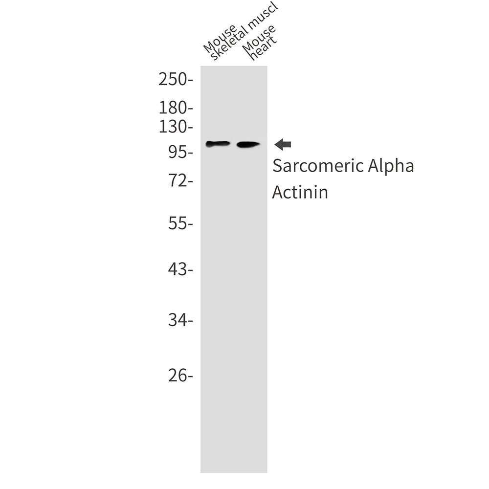 Sarcomeric alpha Actinin Rabbit mAb ABZ2537