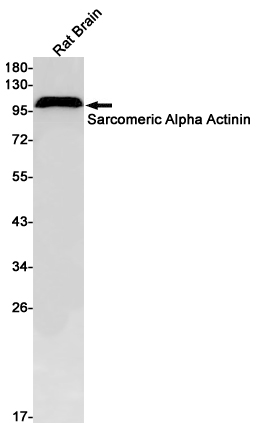 Sarcomeric alpha Actinin Rabbit mAb ABZ2537