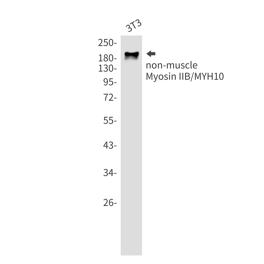 MYH10 Rabbit mAb ABZ2538