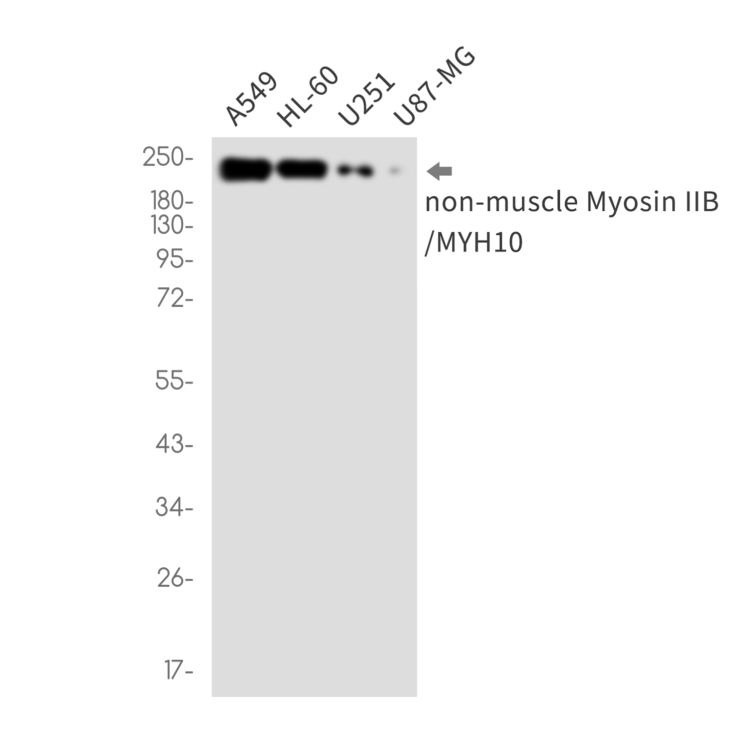 MYH10 Rabbit mAb ABZ2538