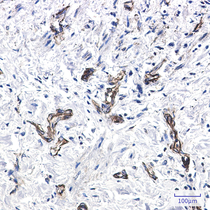 MYH9 Rabbit mAb ABZ2539