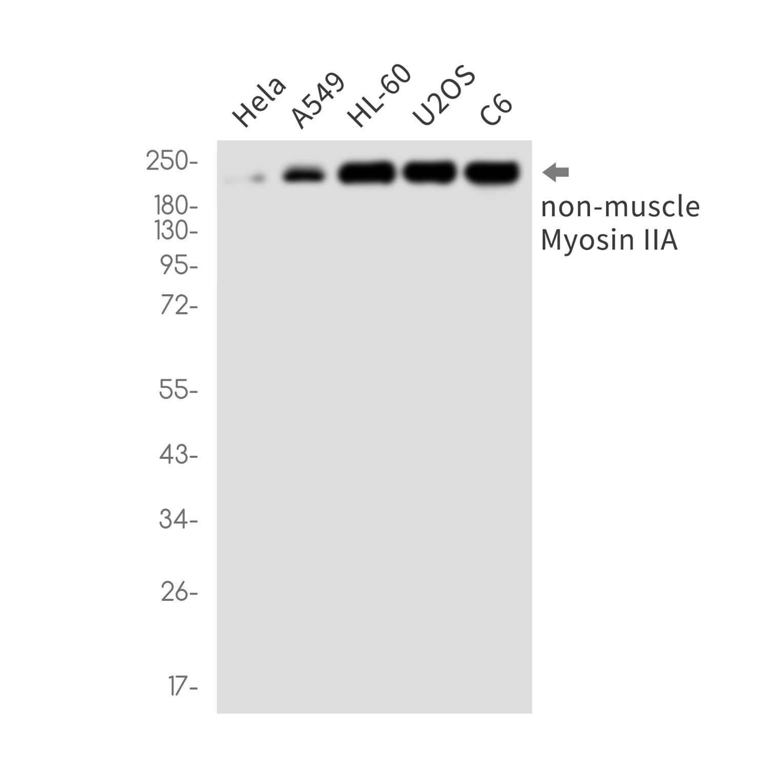 MYH9 Rabbit mAb ABZ2539