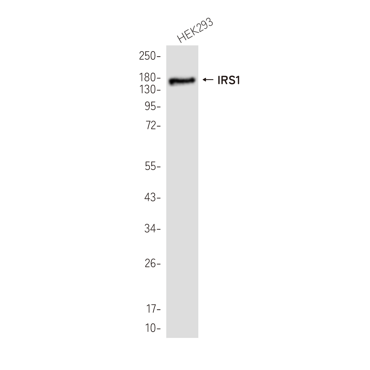 IRS1 Rabbit mAb ABZ2540