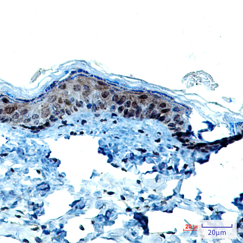 Cytokeratin 9 Rabbit mAb ABZ2541