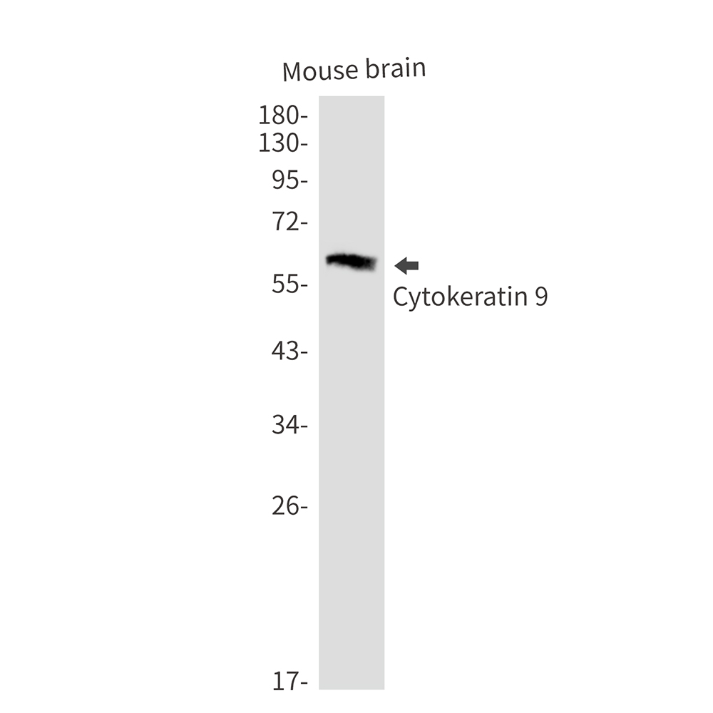 Cytokeratin 9 Rabbit mAb ABZ2541