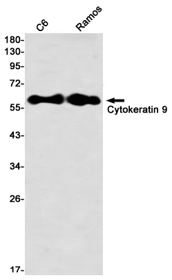 Cytokeratin 9 Rabbit mAb ABZ2541