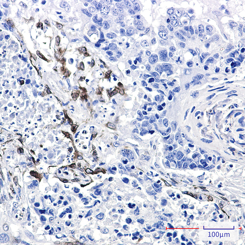 COX2 / Cyclooxygenase 2 Rabbit mAb ABZ2543