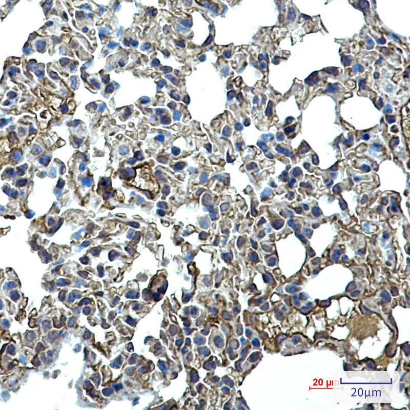 ICAM2 Rabbit mAb ABZ2545