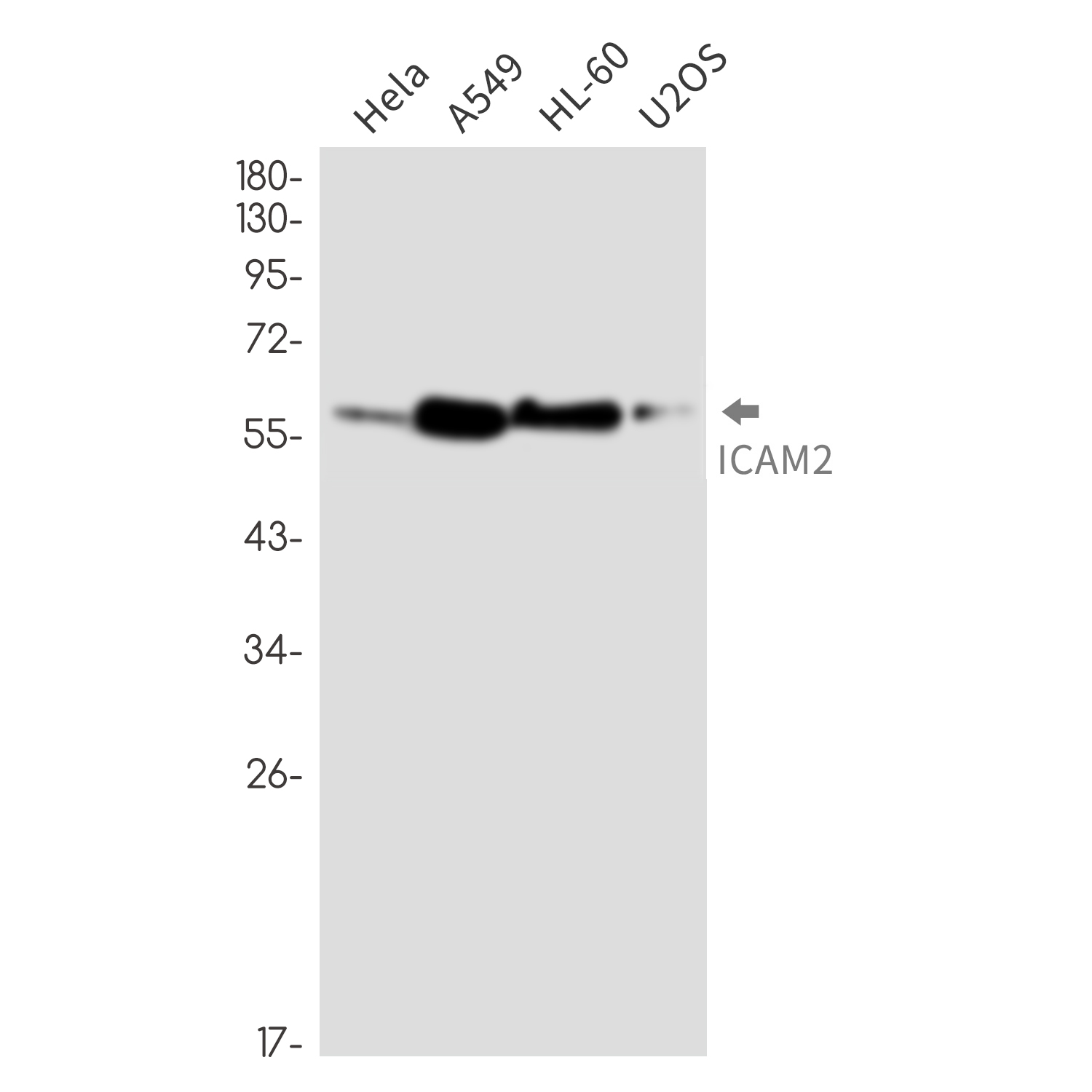ICAM2 Rabbit mAb ABZ2545