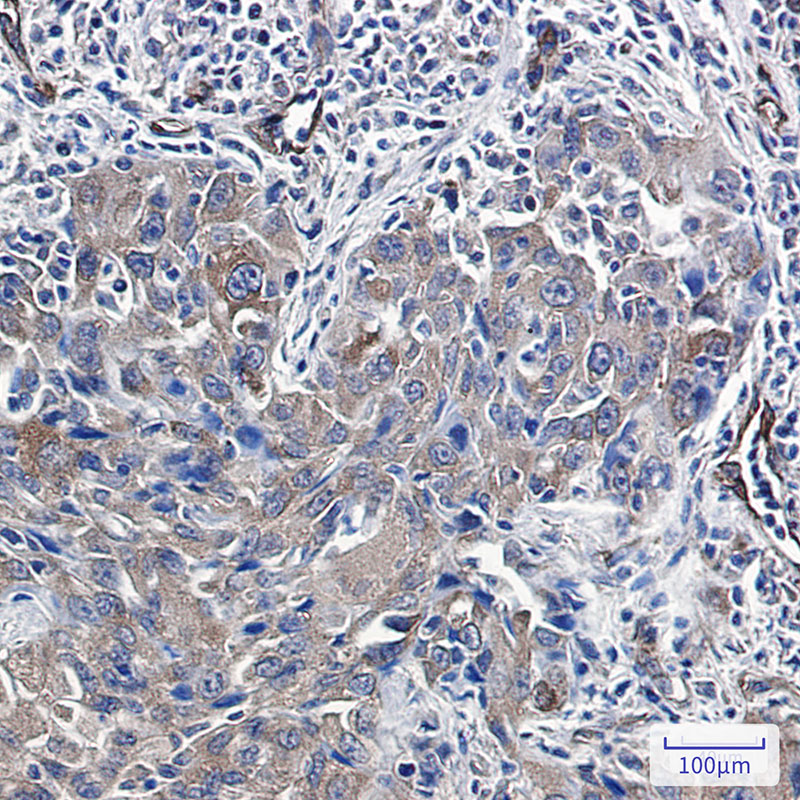 Radixin Rabbit mAb ABZ2546