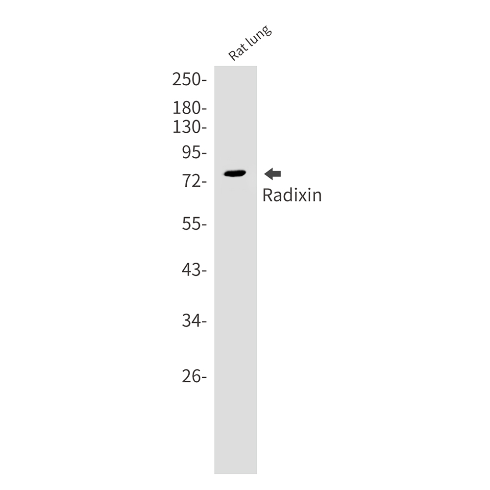 Radixin Rabbit mAb ABZ2546