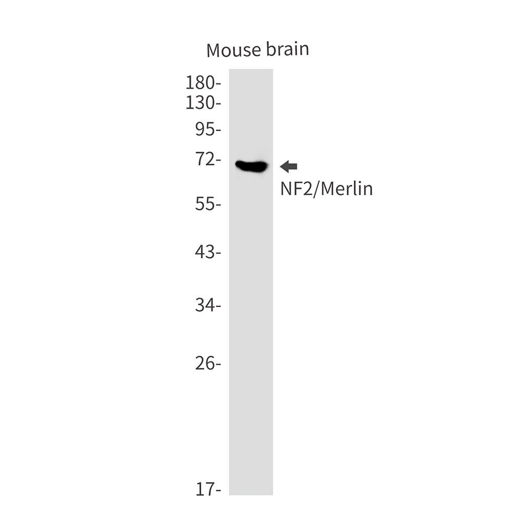 NF2/Merlin Rabbit mAb ABZ2547