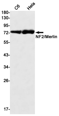 NF2/Merlin Rabbit mAb ABZ2547