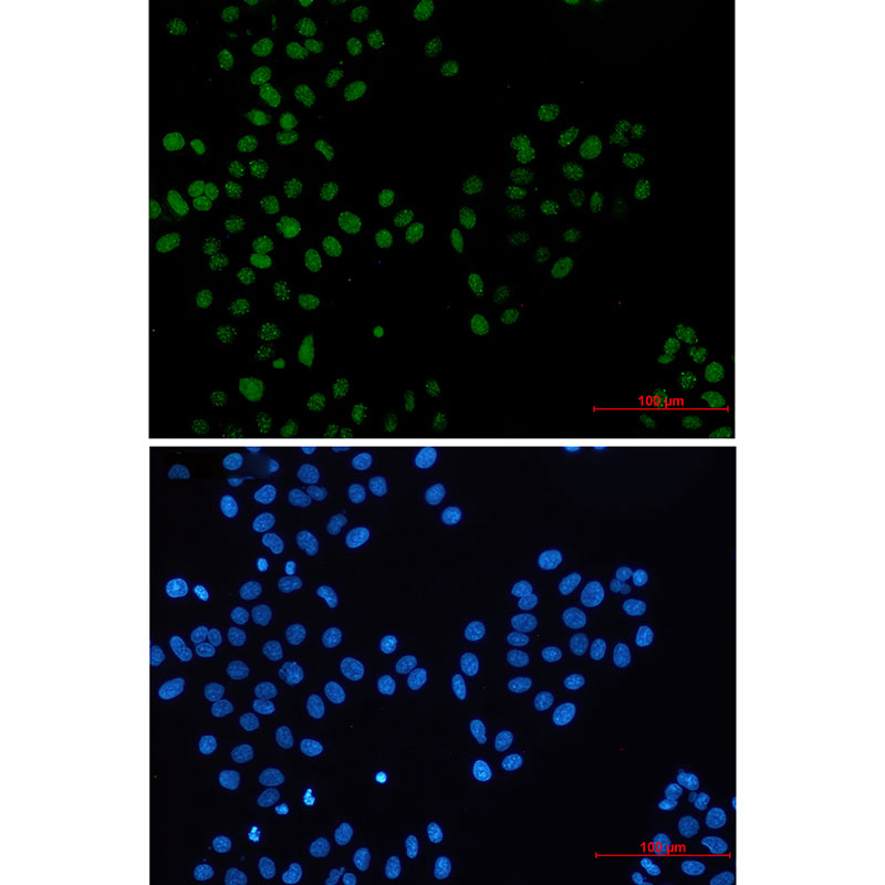 Bmi1 Rabbit mAb ABZ2549