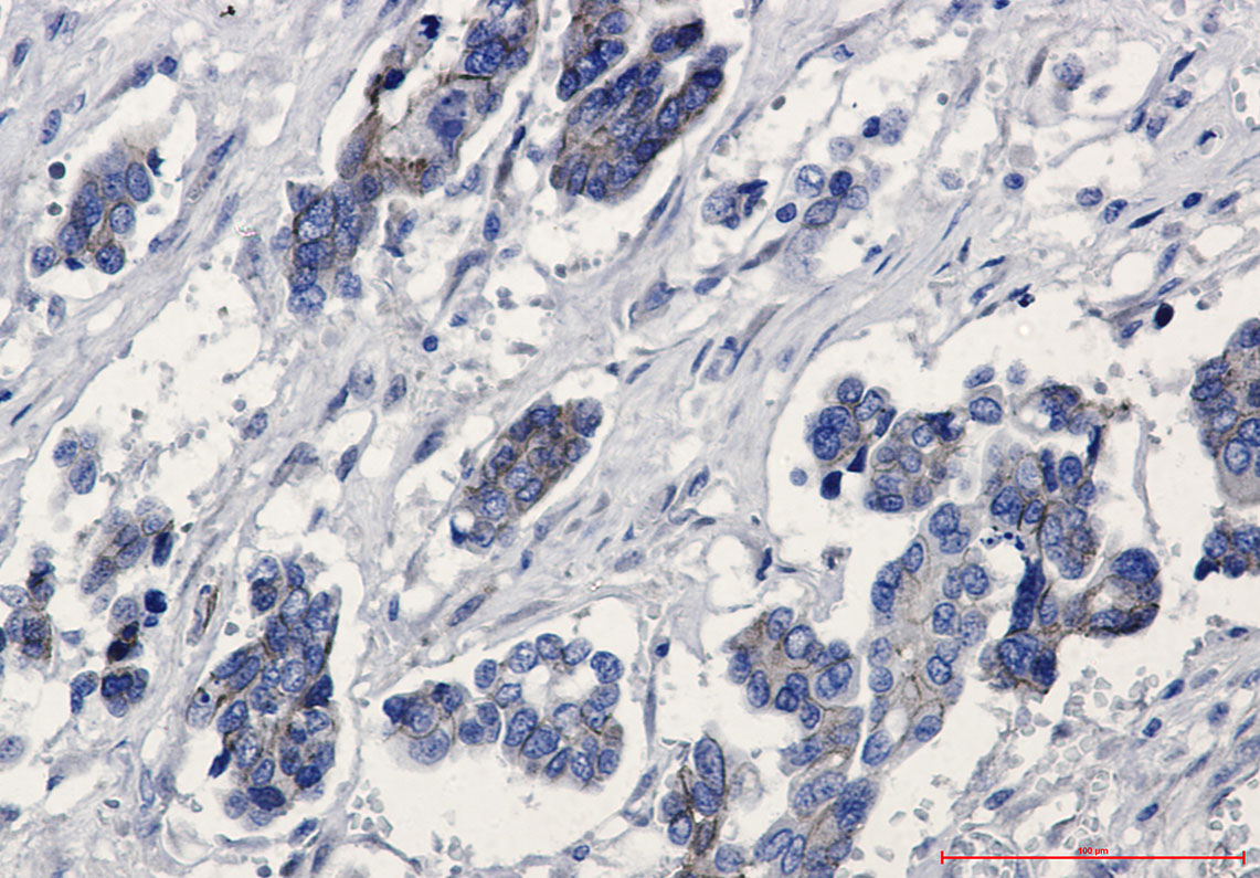 beta Catenin Rabbit mAb ABZ2550