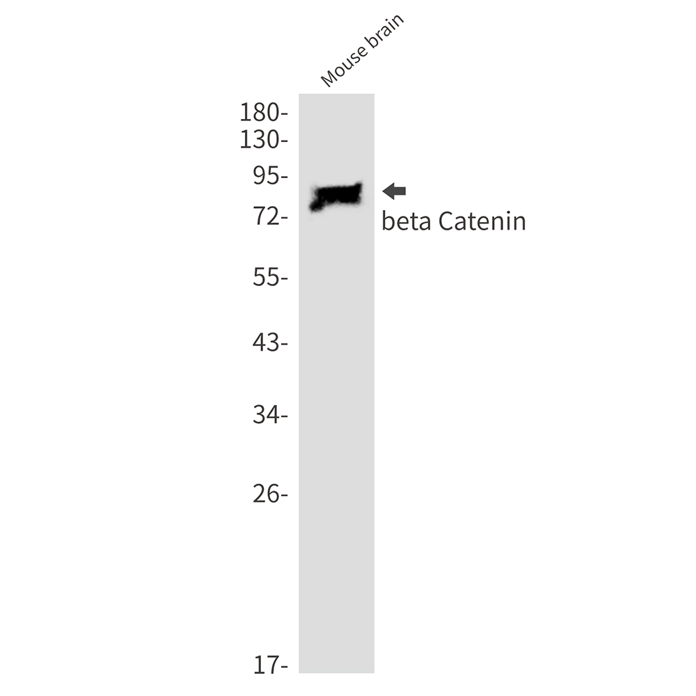 beta Catenin Rabbit mAb ABZ2550