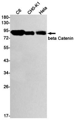 beta Catenin Rabbit mAb ABZ2550