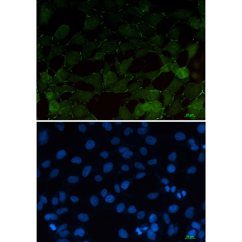 beta Catenin Rabbit mAb ABZ2551