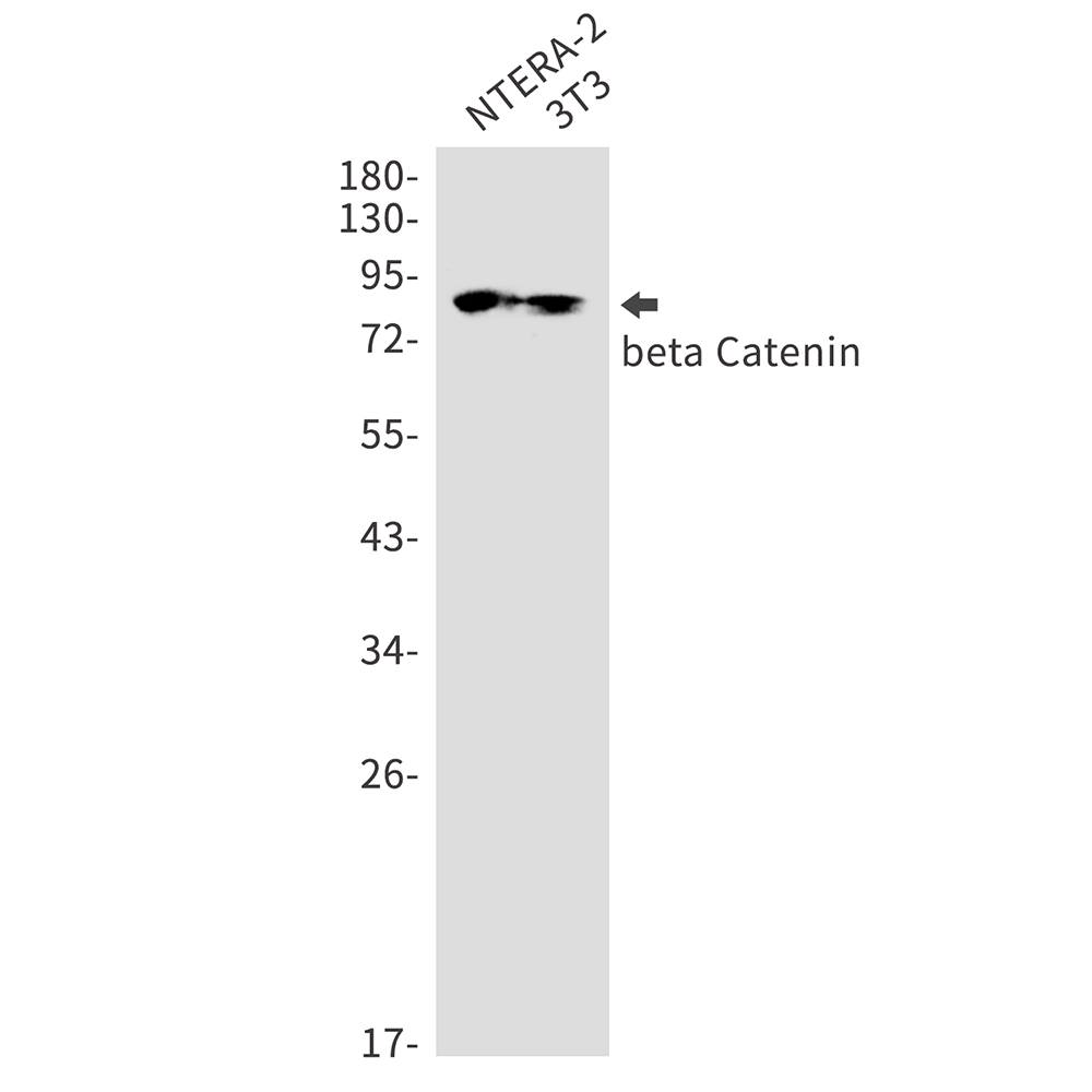 beta Catenin Rabbit mAb ABZ2551