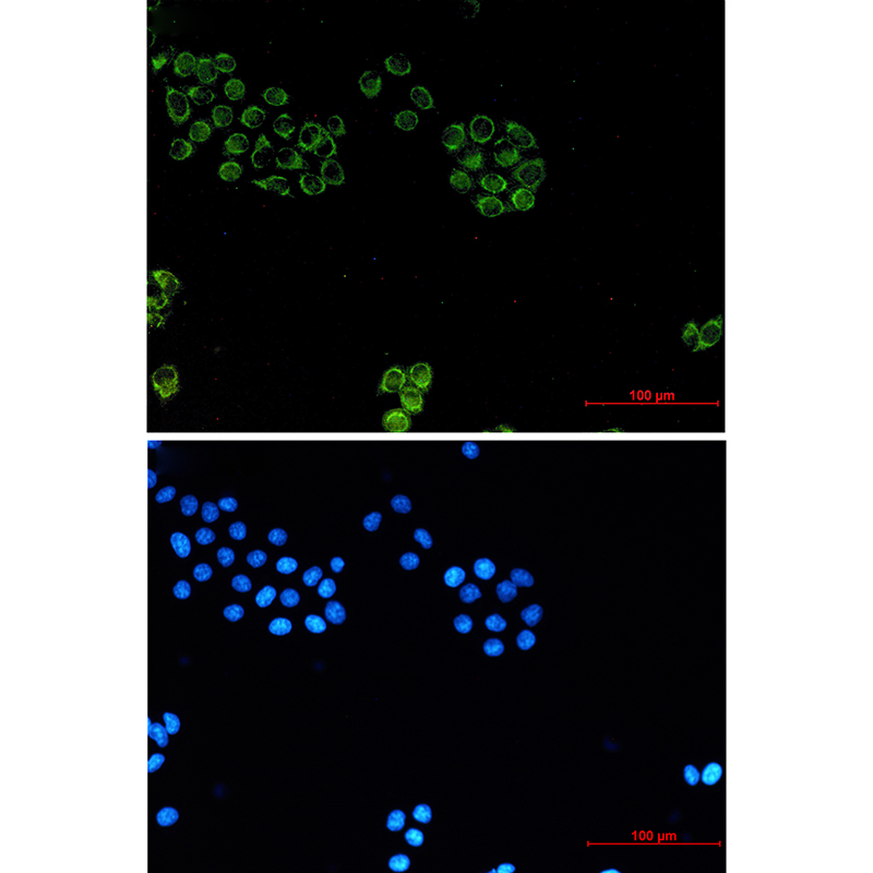Glypican 1/ GPC1 Rabbit mAb ABZ2553