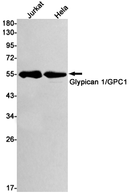 Glypican 1/ GPC1 Rabbit mAb ABZ2553