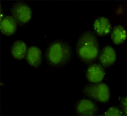GTF2H1 (3E8) Mouse mAb ABZ2554