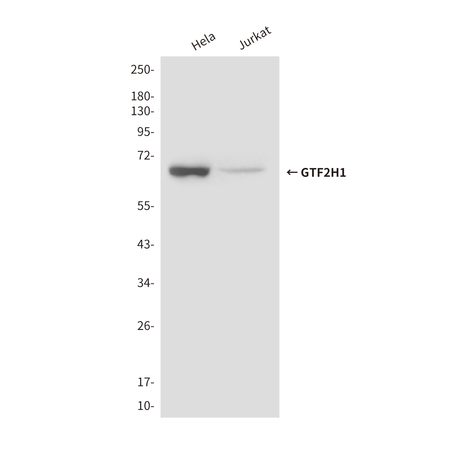 GTF2H1 (3E8) Mouse mAb ABZ2554