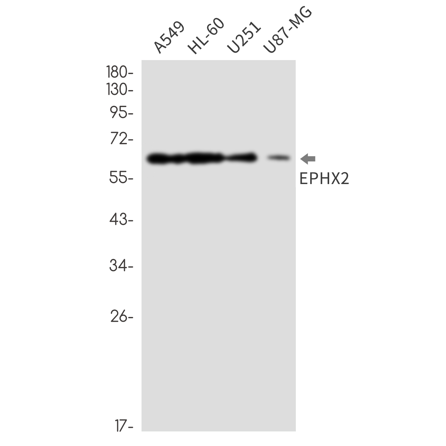 Epoxide Hydrolase 1 Rabbit mAb ABZ2555