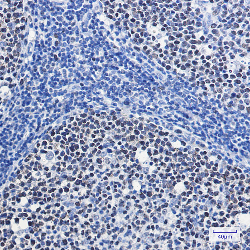 MCM7/PRL Rabbit mAb ABZ2556