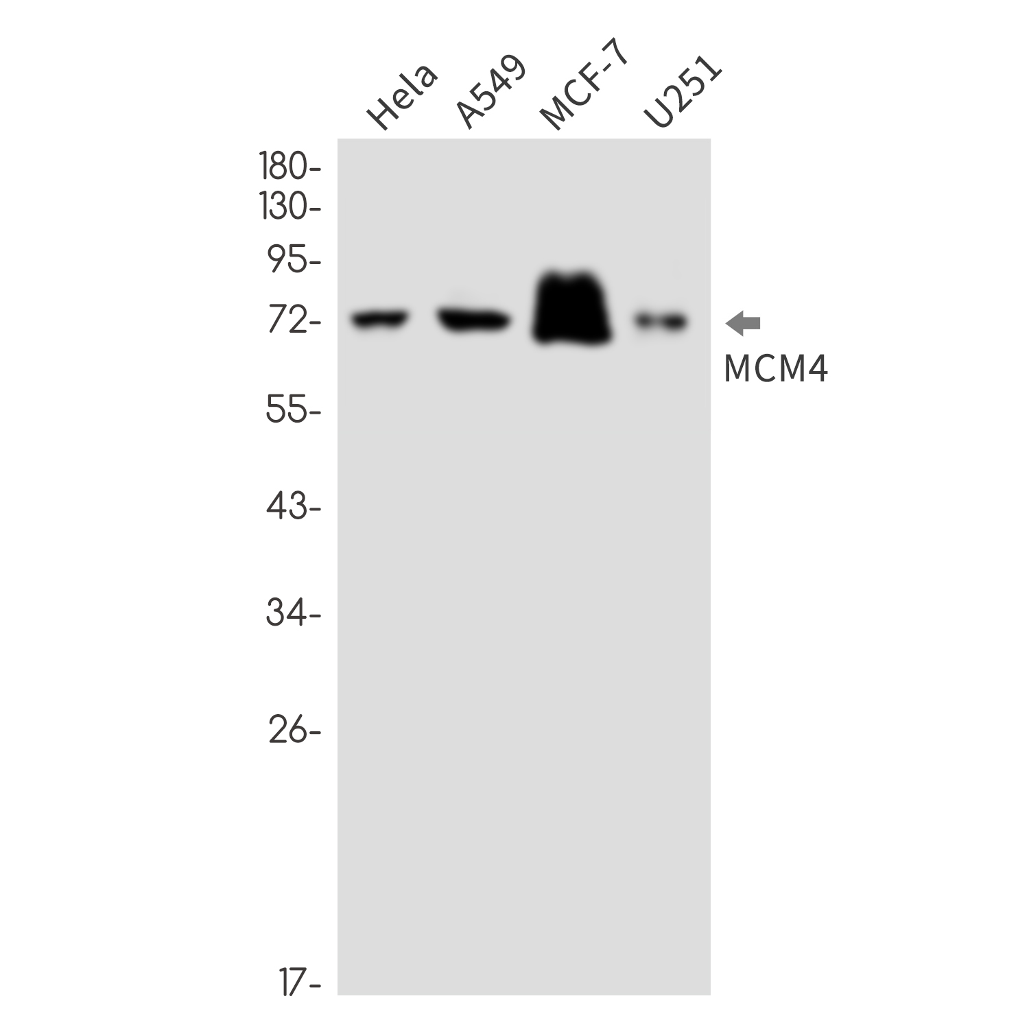 MCM4 Rabbit mAb ABZ2557