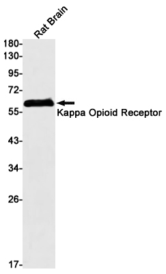 kappa Opioid Receptor Rabbit mAb ABZ2558