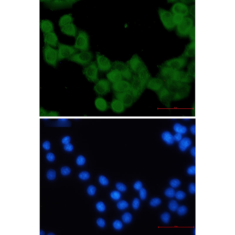 KIF5B Rabbit mAb ABZ2559