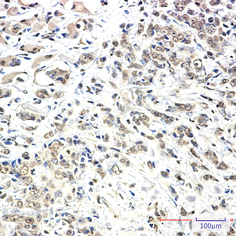 KIF5B Rabbit mAb ABZ2559